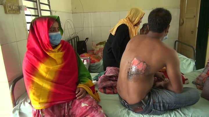 কুষ্টিয়ায় ভাইয়ের ছোঁড়া গরম পানিতে ঝলসে গেছে সহোদর।